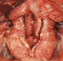 swollen kidneys