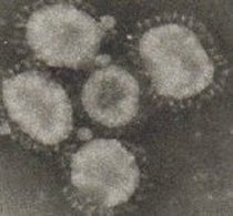 IB virus